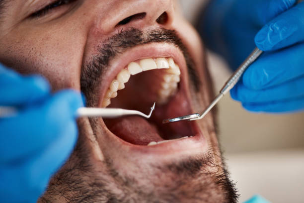 Best Emergency Treatment for Jaw Pain or Injury in Sweet Home, OR